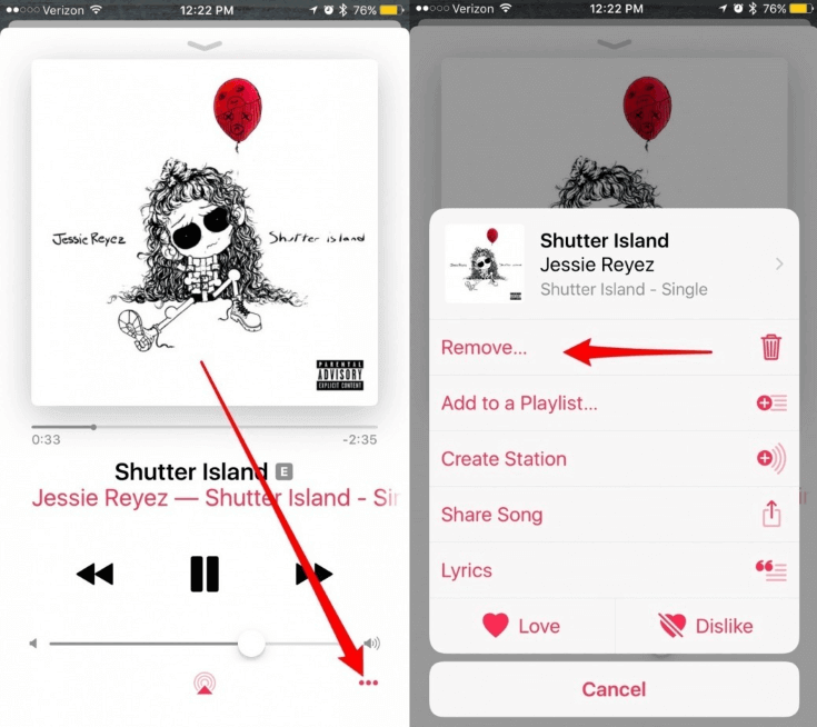 حذف Apple Music Library iPhone إزالة